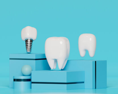 Can I Get Dental Implants If I Have Gum Disease?