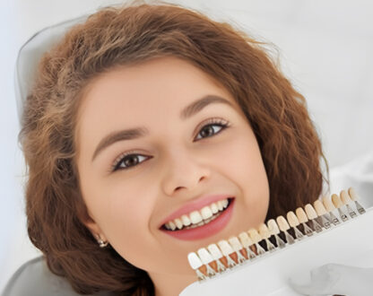 The Benefits of Choosing Dental Veneers for a Perfect Smile
